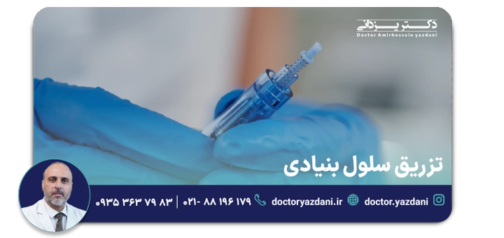 تزریق سلول بنیادی